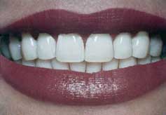 Dientes